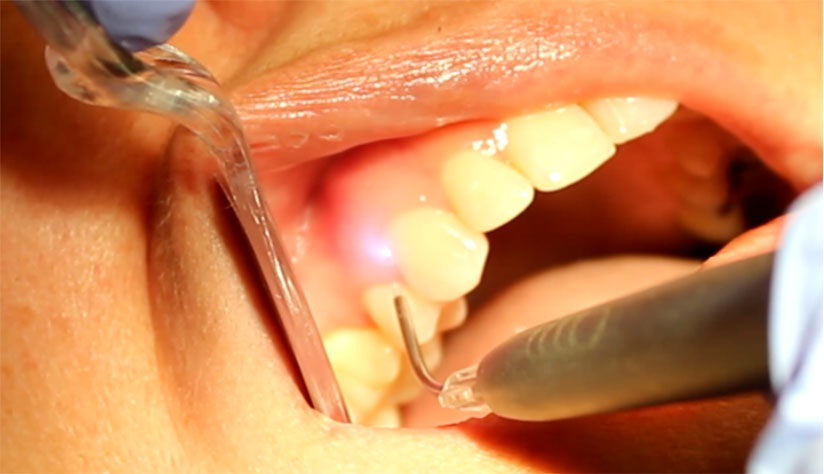 dental laser CE courses