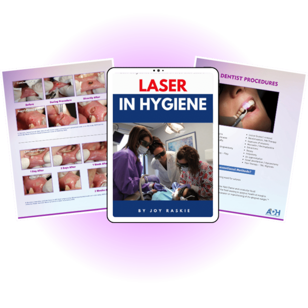 Diode Laser Certification A Guide to Advancing Your Dental Skills